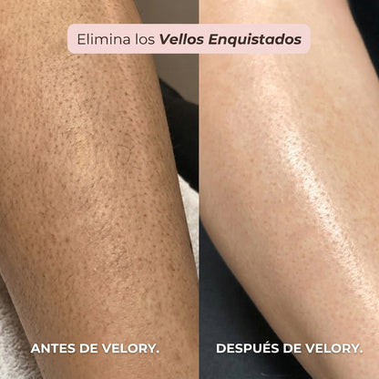 Afeitadora Íntima Femenina™