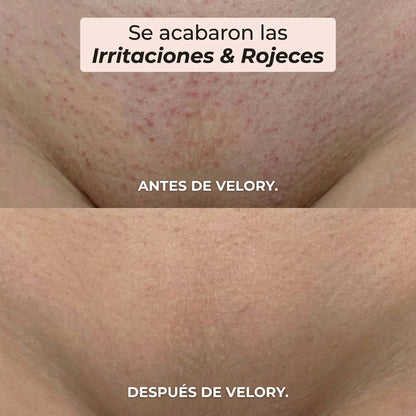 Afeitadora Íntima Femenina™